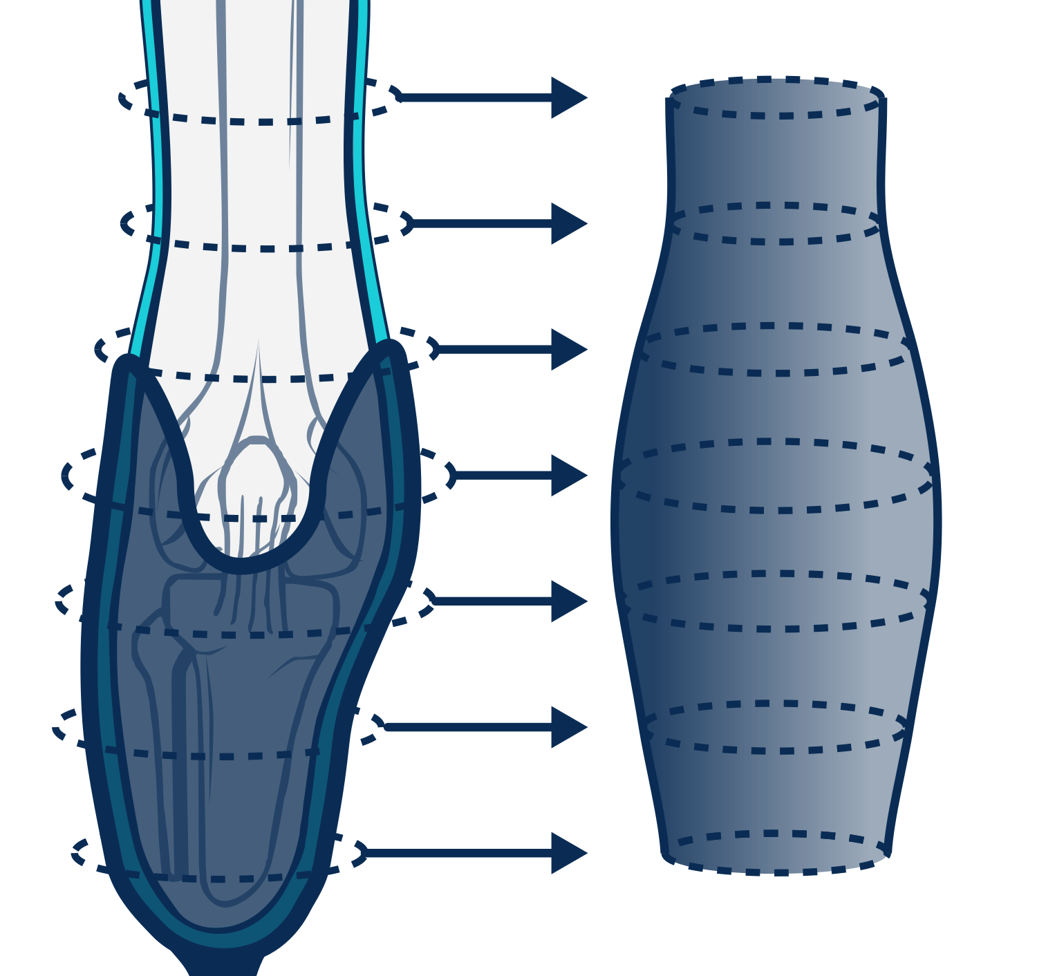 Measured perimeters aligned on two axes produce the sleeve shape