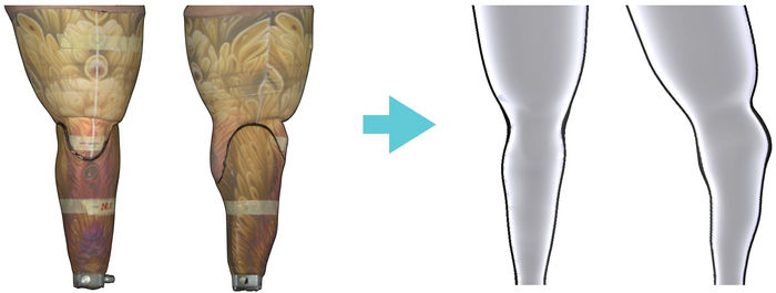 Sleeve shape generated from a 3D scan of the limb and socket