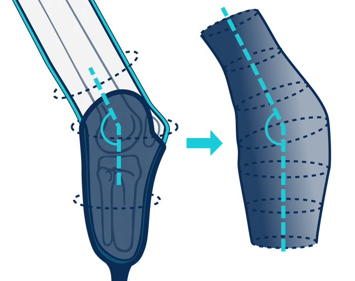 Sleeve shape built from measurements on two axes