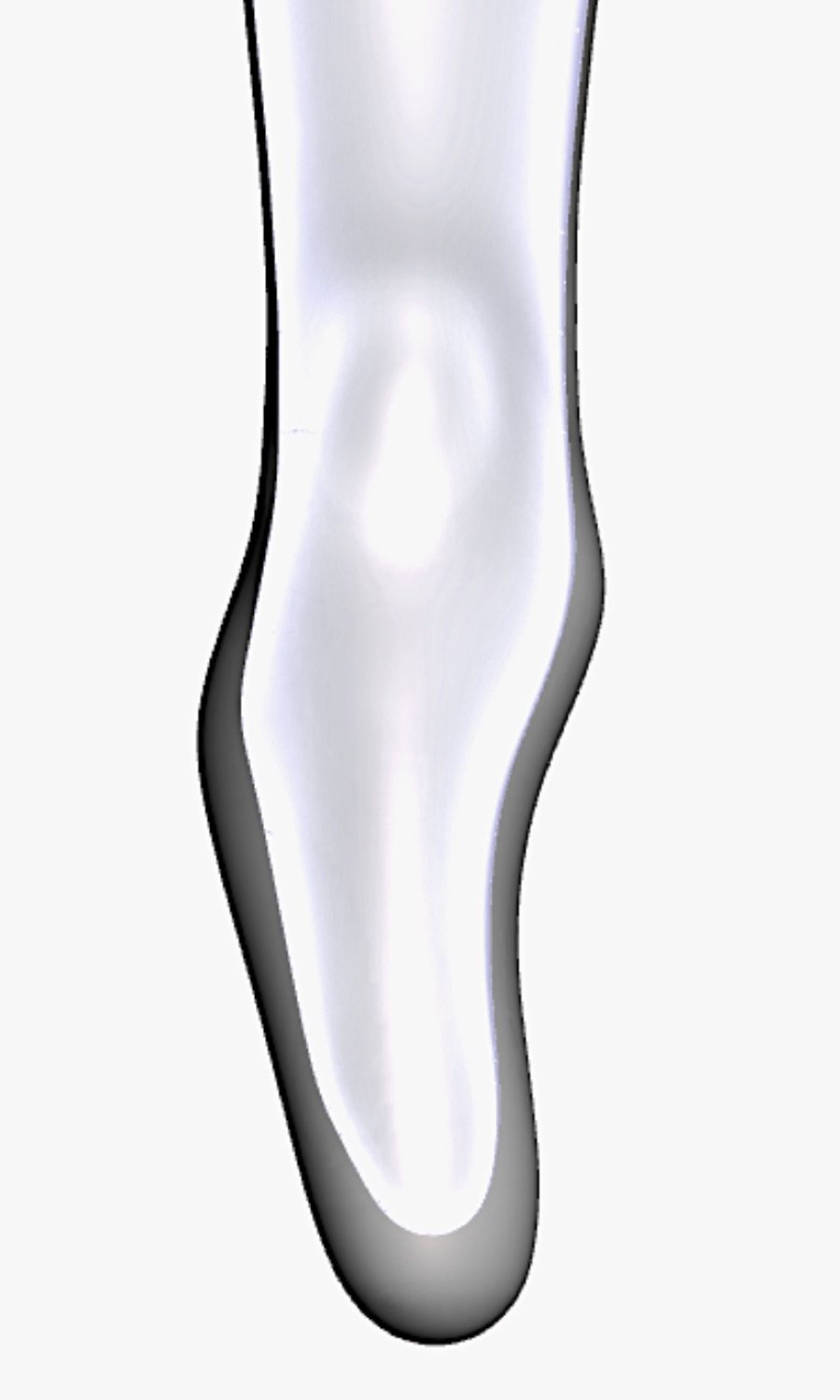 Prominent Condyle &mdash; 3D Model