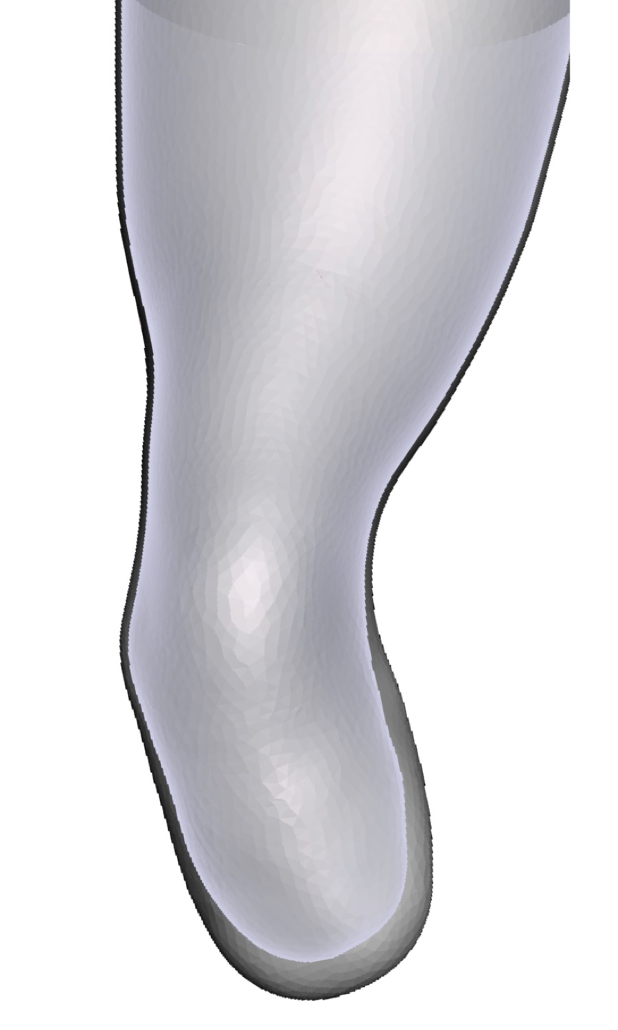 Varus/Valgus &mdash; Limb