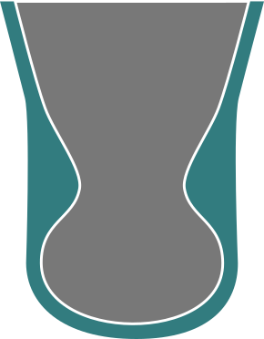 Fully-compensated liner fills the protruding distal segment
