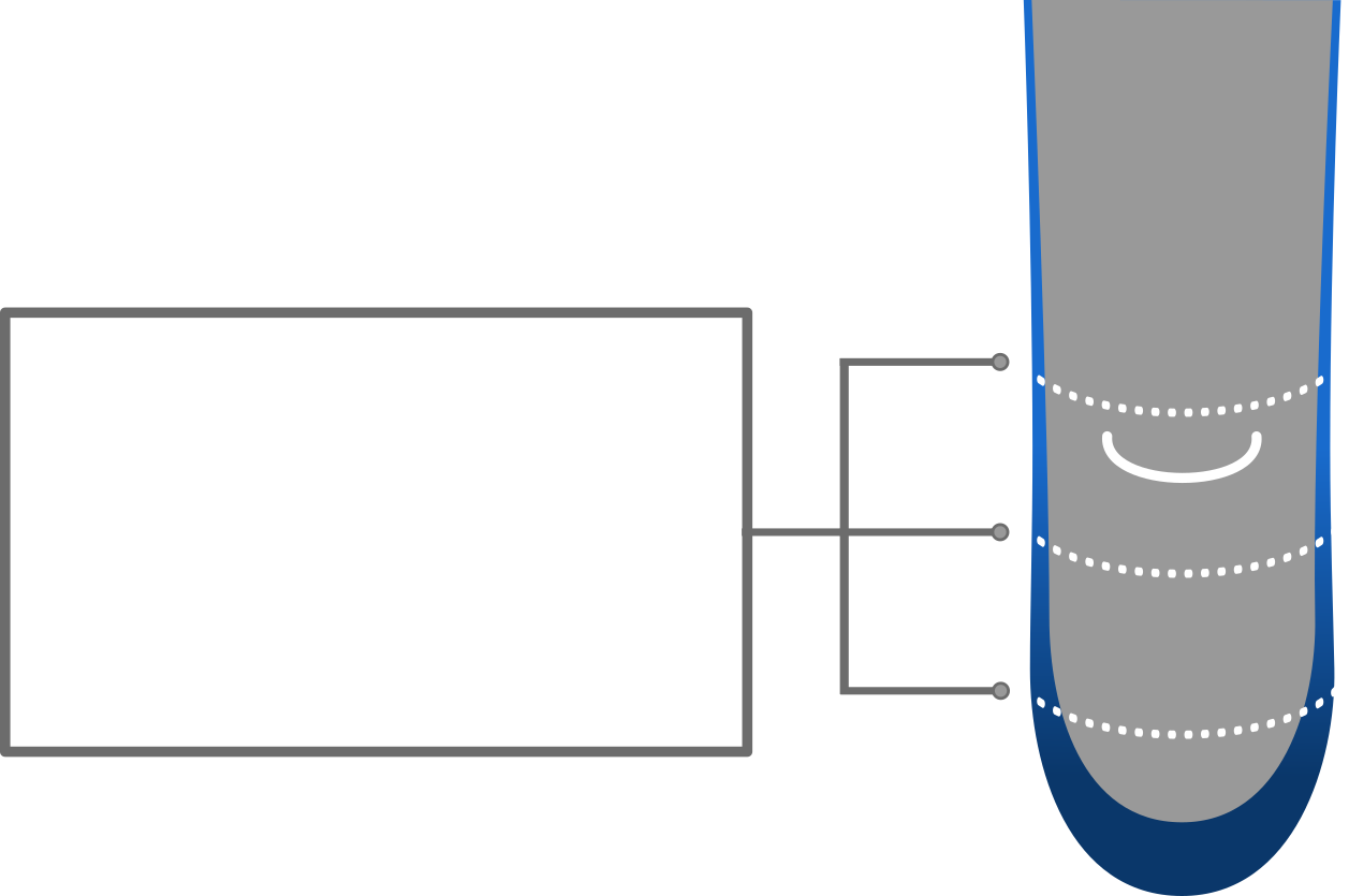 Liner cross-section: the same wall thickness all around the limb at any given height